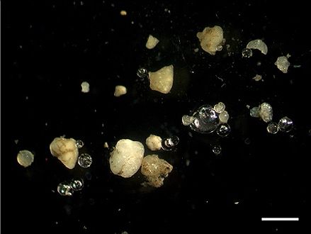 File:Microplastics in sediment from the Rhine.jpg