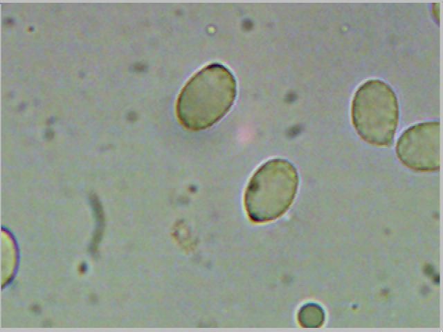 File:Amanita muscaria spores.jpg