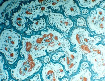 File:Bone Cells (10835380615).jpg