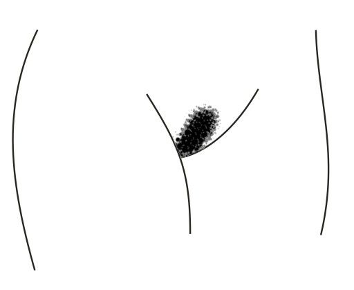 File:Bikini lines.jpg