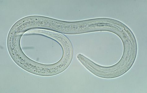 File:Hookworm filariform A.jpg