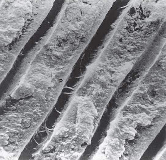 File:Dentinal tubules.jpg