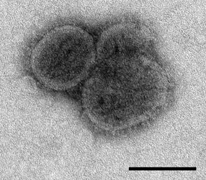 File:Bourbon virus sphere (EID 2015 Fig 2b).jpg