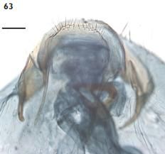 File:Ectoedemia heckfordi female terminal abdominal segment.JPG