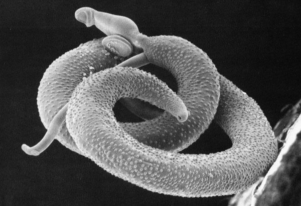 File:Schistosoma mansoni2.jpg