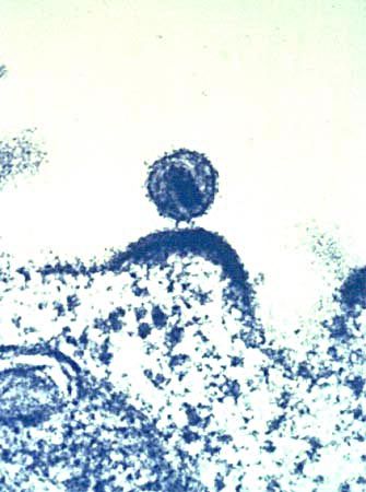 File:Hiv budding.jpg