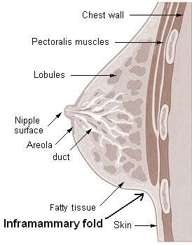 File:Imframammary fold.jpg