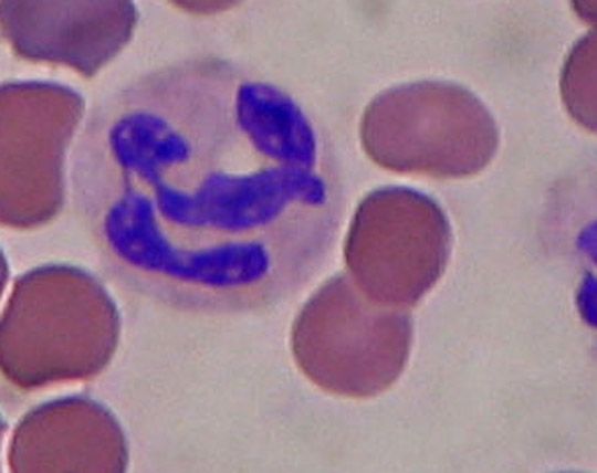 File:Neutrophil in a blood smear.jpg