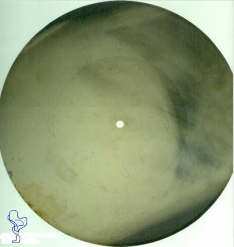 File:X ray record.jpg