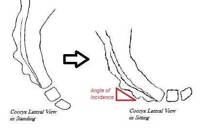 File:Stand to Sit Coccyx.jpg