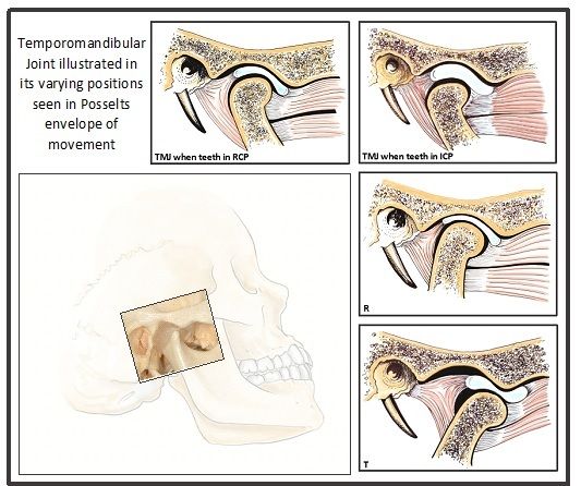 File:TMJ movements.jpg