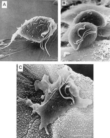 File:Trichomonas vaginalis (21).JPG