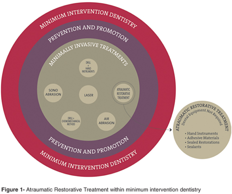 File:ART in Minimally Intervention Dentistry.png