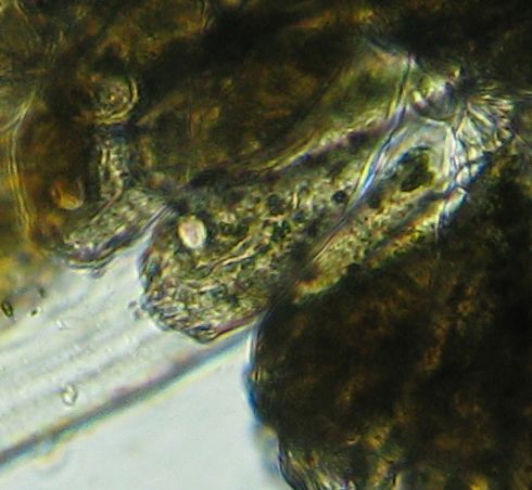 File:Opercularia ampluscolonia close up.jpg