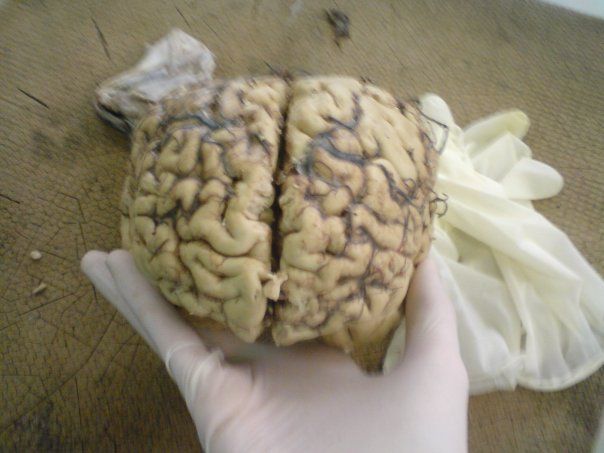 File:Brain dissection.jpg