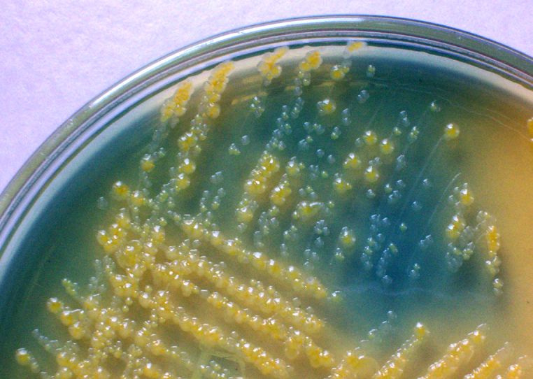 File:Lactose non lactose fermenters on CLED agar.jpg