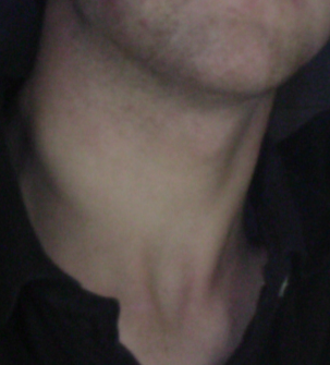 File:Neck.png