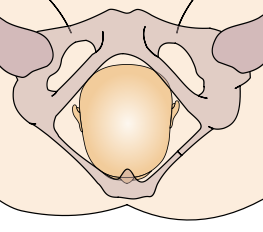 File:Cephalic presentation - straight occipito-anterior.png