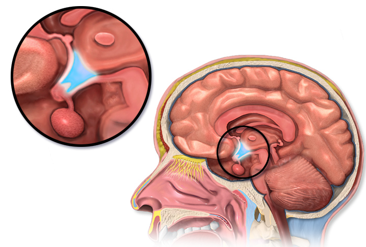 File:Blausen 0536 HypothalamusLocation.png