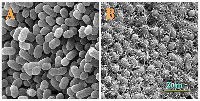 File:EColiCRIS051-Fig2.jpg