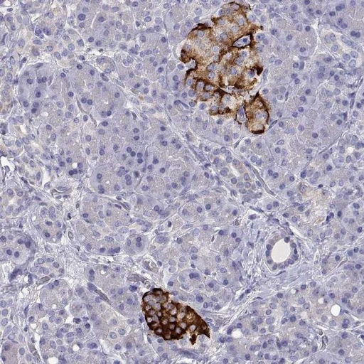 File:TMEM211 antibody.png