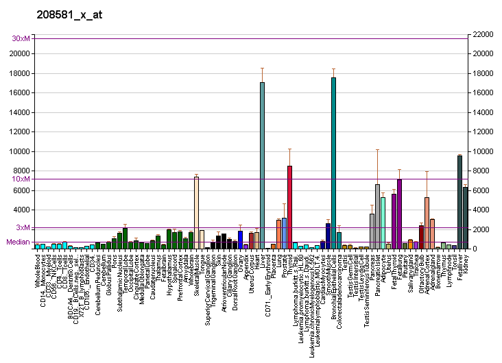 File:PBB GE MT1X 208581 x at fs.png