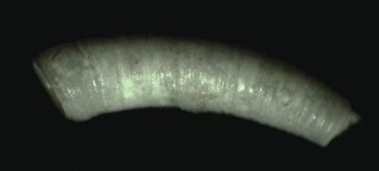 File:Caecum trachea 001.jpg