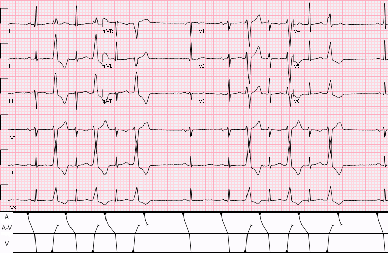 File:Concealed conduction.png