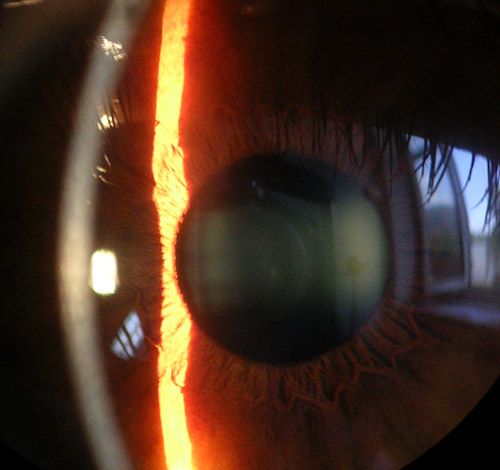 File:Cornea.jpg