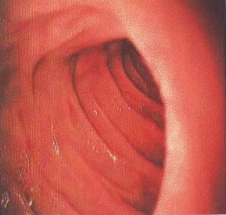 File:Human duodenum.jpg