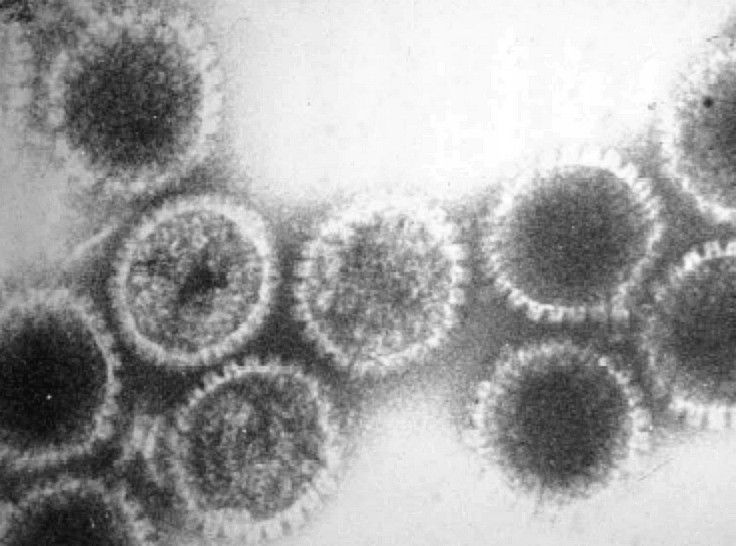 File:Herpes virus00.jpg