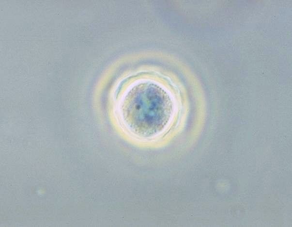 File:Acanthamoeba polyphaga cyst.jpg