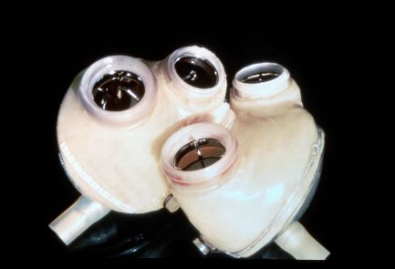 File:JARVIK 7 artificial heart.jpg