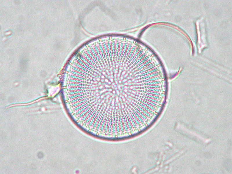 File:Stephanodiscus neoastraea.jpeg