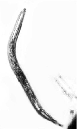 File:Formicodiplogaster myrmenema dauer juvenile.jpg