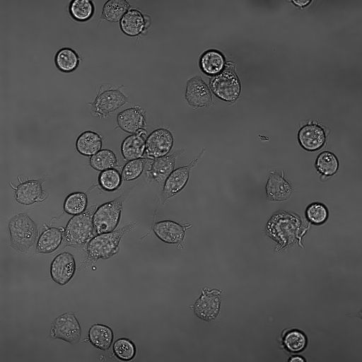 File:RBL (Rat Basophilic Leukaemia) Cell Line.jpg