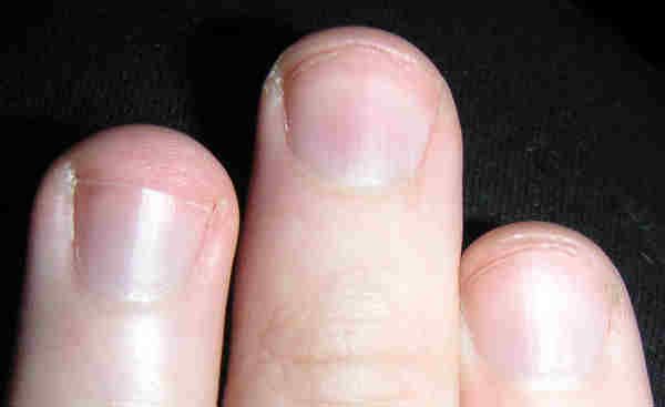 File:Fingernails.jpg