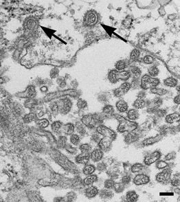 File:Bourbon virus endocytosis (EID 2015 Fig 2d).jpg