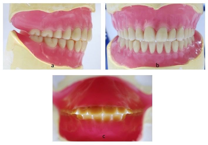 File:Non-Balanced Occlusion .jpg