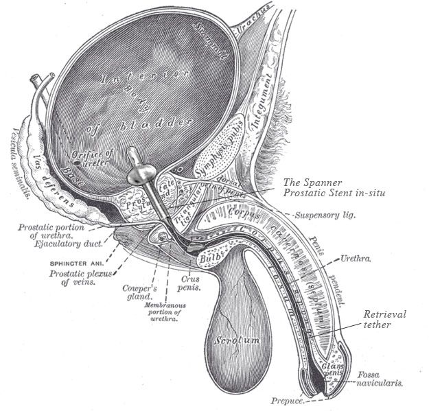 File:Spanner insitu.jpg