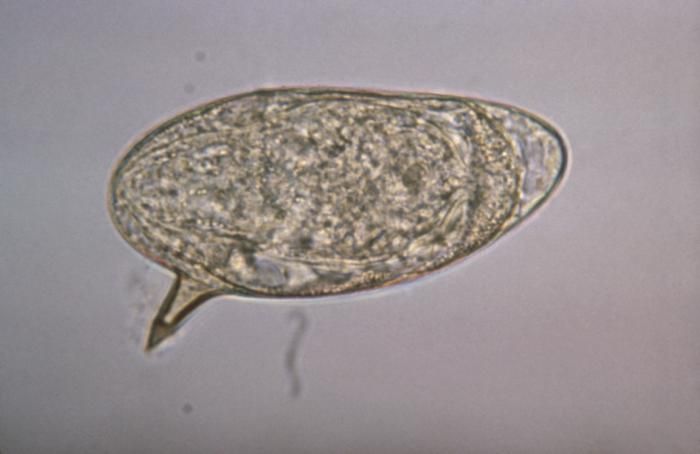 File:Schistosoma mansoni egg 4841 lores.jpg