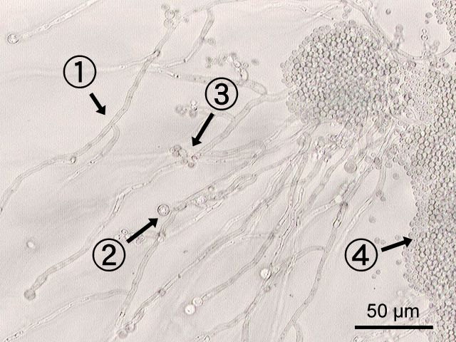 File:C albicans labeled.jpg