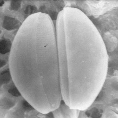 File:Pennate diatoms (3075304186).jpg