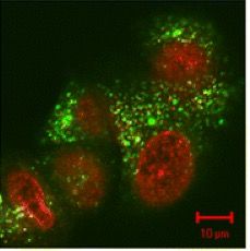 File:Doxorubicin localisation.jpg