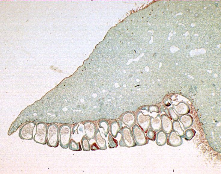 File:Cycas microsporophyll microsporangia2.jpg