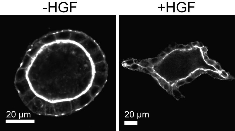 File:Branching morphogenesis in 3D cell culture.jpg