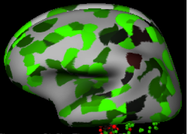 Sagittal view