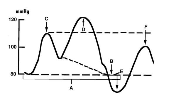 File:Ballondruckkurve.JPG