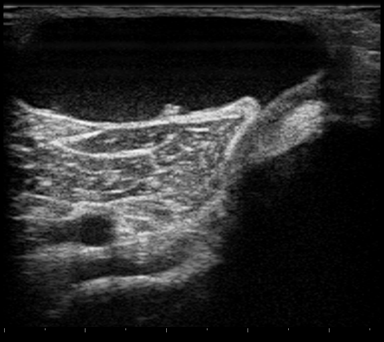 File:Ultrasound Scan ND 0125091859 0930540.png