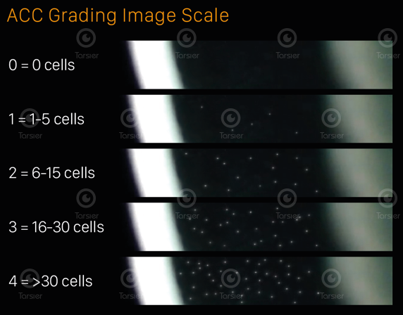 File:ACC Anterior Chamber Cell Grading Scale.png